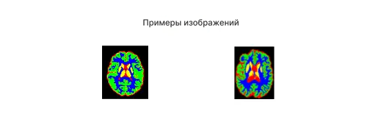 brain_segmentation_1_ru.png
